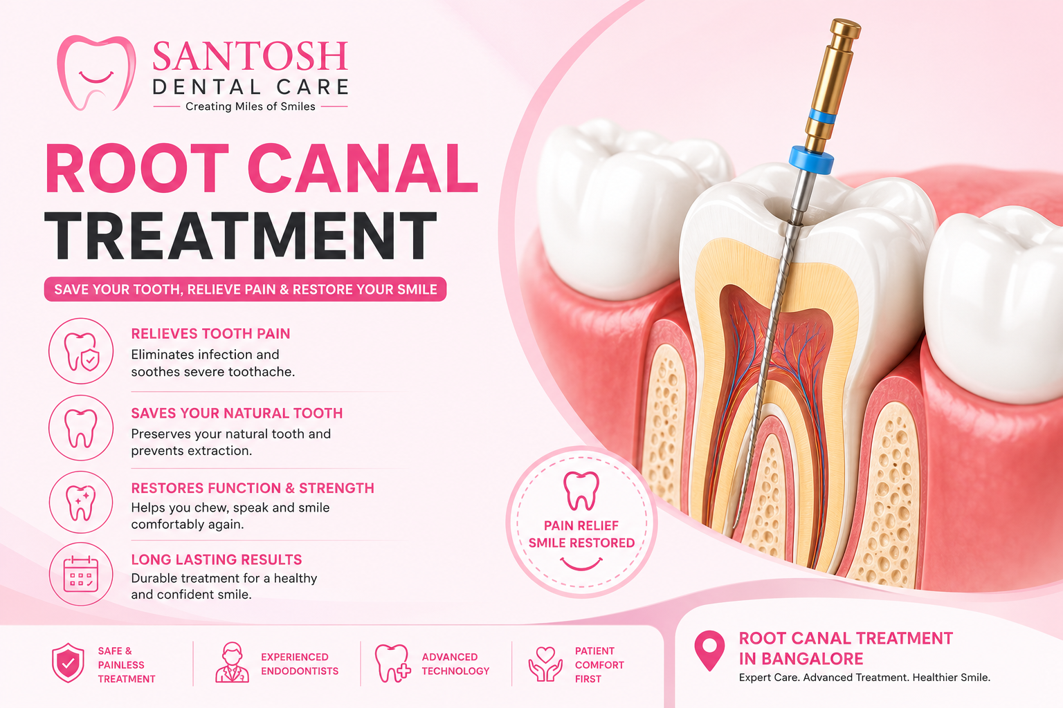 root canal treatment